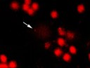 Fotos das células de fígado. Ao centro, verifica-se uma célula com o DNA fragmentado, apontada pela seta.