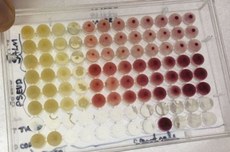 Microplacas com poços contendo bactérias cultivadas. A imagem mostra os poços onde as diferentes concentrações do óleo essencial de mirra inibiram o crescimento bacteriano (poços amarelos) e onde há crescimento das mesmas (poços vermelhos)